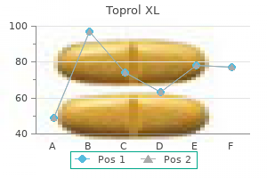 buy toprol xl 25 mg free shipping