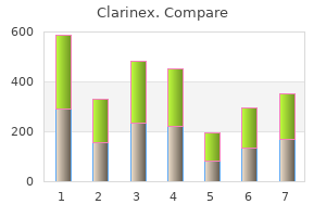5 mg clarinex discount overnight delivery